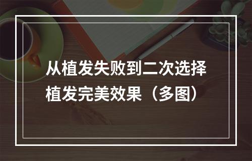 从植发失败到二次选择植发完美效果（多图）