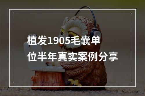 植发1905毛囊单位半年真实案例分享