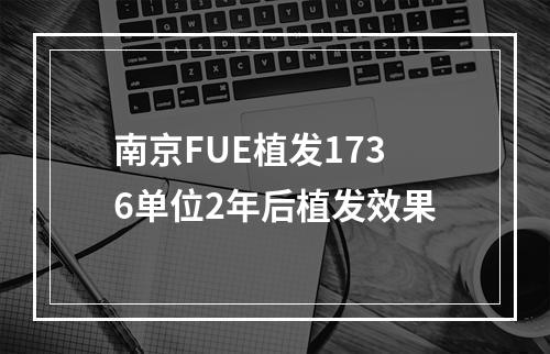 南京FUE植发1736单位2年后植发效果