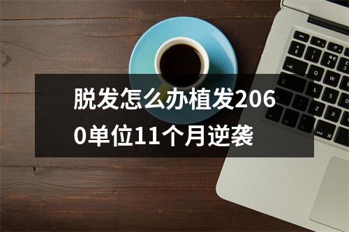 脱发怎么办植发2060单位11个月逆袭