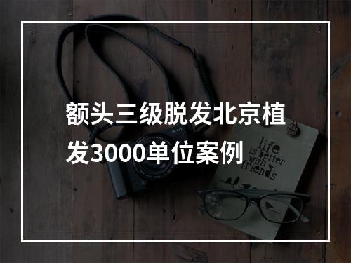 额头三级脱发北京植发3000单位案例