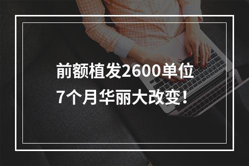 前额植发2600单位7个月华丽大改变！