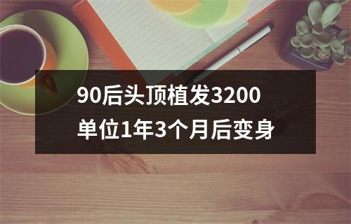 90后头顶植发3200单位1年3个月后变身