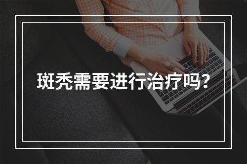 斑秃需要进行治疗吗？