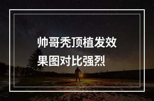 帅哥秃顶植发效果图对比强烈