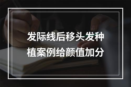 发际线后移头发种植案例给颜值加分