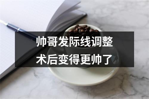 帅哥发际线调整术后变得更帅了