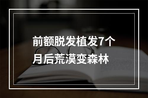 前额脱发植发7个月后荒漠变森林