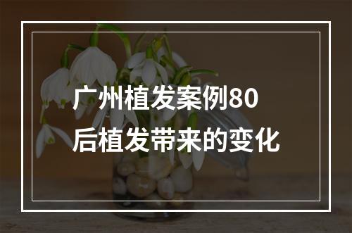 广州植发案例80后植发带来的变化