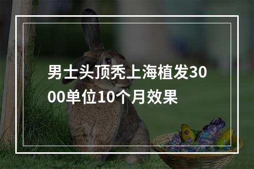 男士头顶秃上海植发3000单位10个月效果