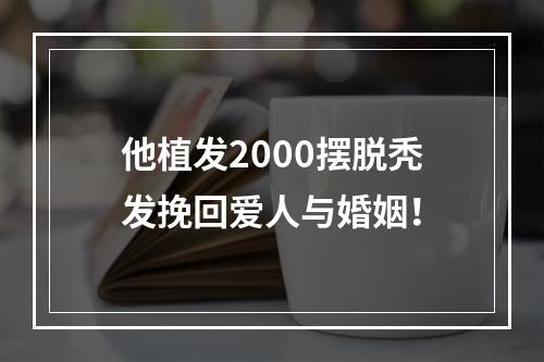 他植发2000摆脱秃发挽回爱人与婚姻！