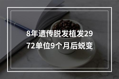 8年遗传脱发植发2972单位9个月后蜕变