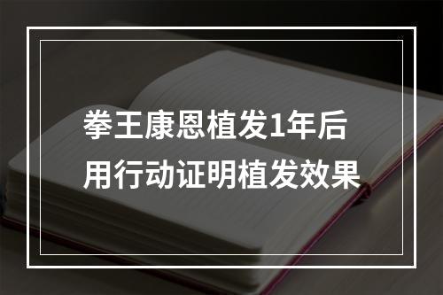 拳王康恩植发1年后用行动证明植发效果