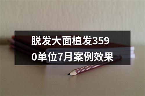 脱发大面植发3590单位7月案例效果