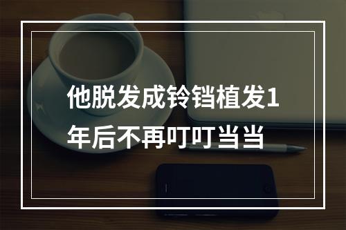 他脱发成铃铛植发1年后不再叮叮当当