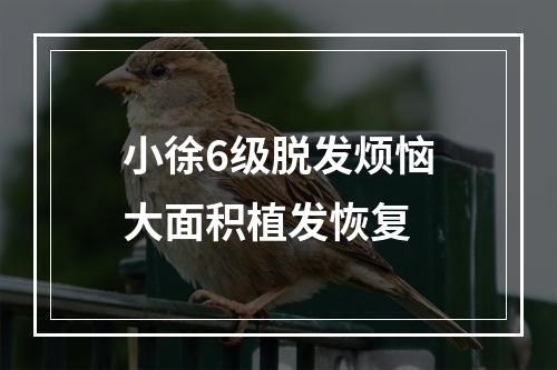 小徐6级脱发烦恼大面积植发恢复