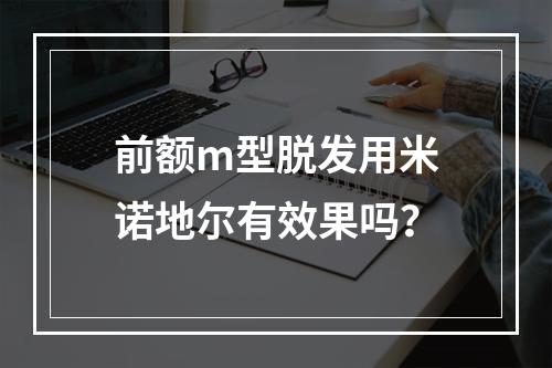 前额m型脱发用米诺地尔有效果吗？