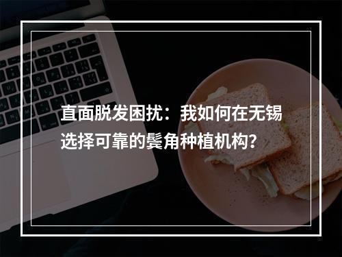 直面脱发困扰：我如何在无锡选择可靠的鬓角种植机构？