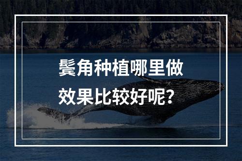 鬓角种植哪里做效果比较好呢？