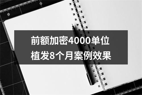 前额加密4000单位植发8个月案例效果