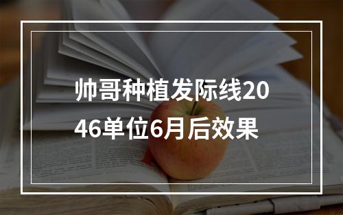 帅哥种植发际线2046单位6月后效果