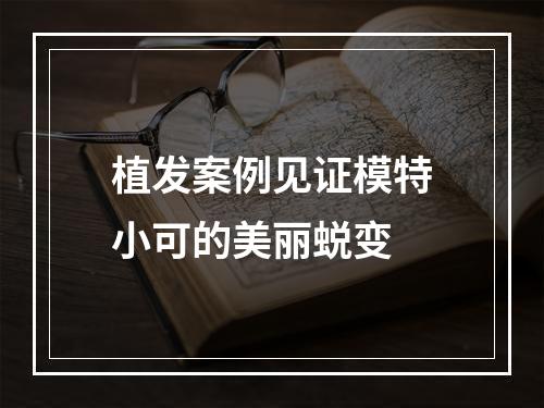 植发案例见证模特小可的美丽蜕变