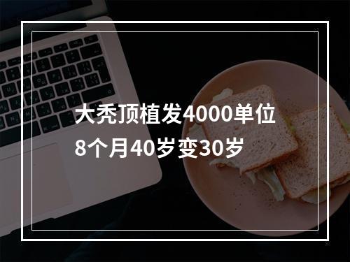 大秃顶植发4000单位8个月40岁变30岁