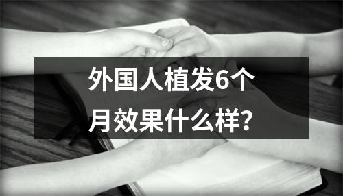 外国人植发6个月效果什么样？