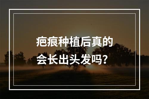 疤痕种植后真的会长出头发吗？