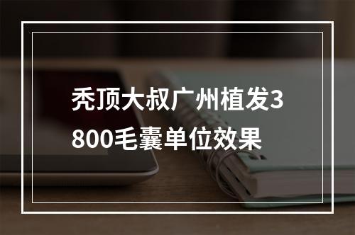 秃顶大叔广州植发3800毛囊单位效果