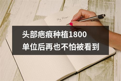 头部疤痕种植1800单位后再也不怕被看到