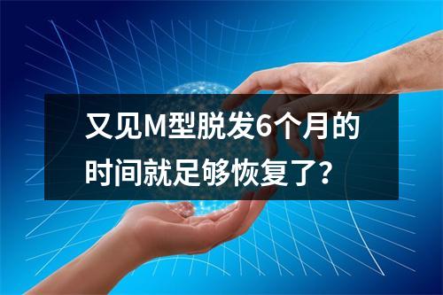 又见M型脱发6个月的时间就足够恢复了？