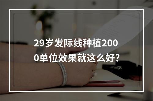 29岁发际线种植2000单位效果就这么好？