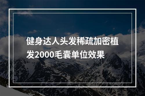 健身达人头发稀疏加密植发2000毛囊单位效果