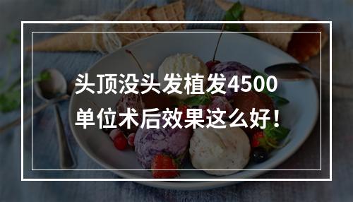 头顶没头发植发4500单位术后效果这么好！