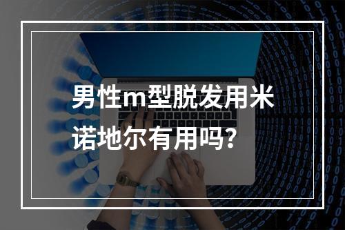 男性m型脱发用米诺地尔有用吗？