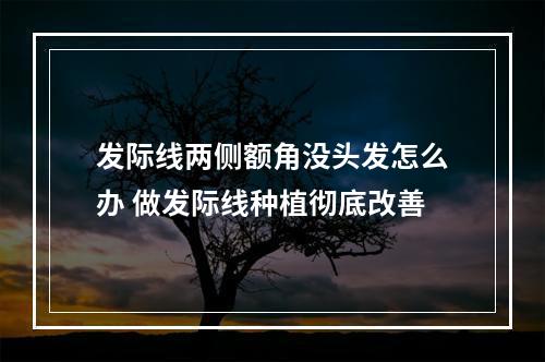 发际线两侧额角没头发怎么办 做发际线种植彻底改善