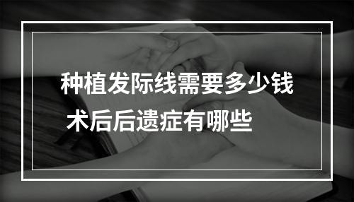 种植发际线需要多少钱 术后后遗症有哪些