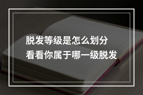 脱发等级是怎么划分 看看你属于哪一级脱发