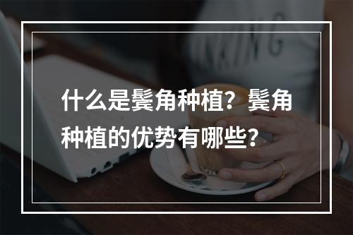 什么是鬓角种植？鬓角种植的优势有哪些？