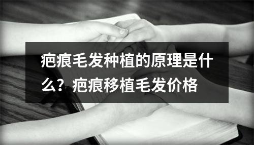 疤痕毛发种植的原理是什么？疤痕移植毛发价格