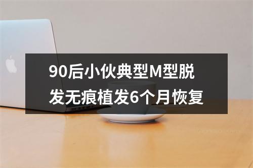 90后小伙典型M型脱发无痕植发6个月恢复