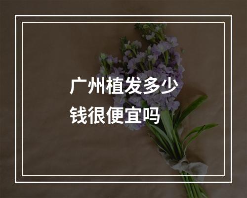 广州植发多少钱很便宜吗