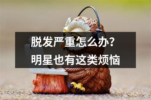 脱发严重怎么办？明星也有这类烦恼