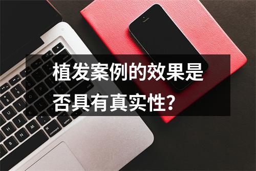 植发案例的效果是否具有真实性？