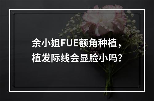 余小姐FUE额角种植，植发际线会显脸小吗？