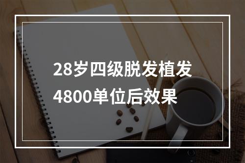 28岁四级脱发植发4800单位后效果