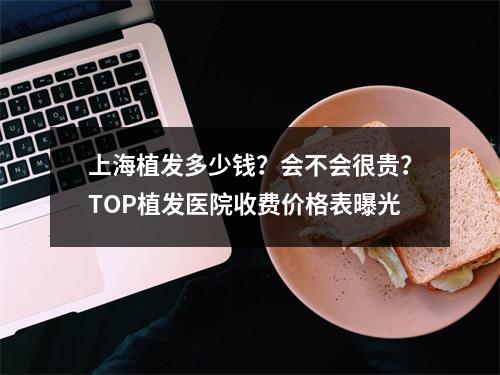 上海植发多少钱？会不会很贵？TOP植发医院收费价格表曝光