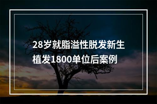 28岁就脂溢性脱发新生植发1800单位后案例