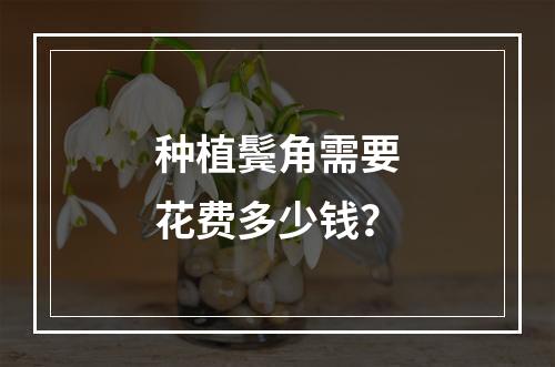 种植鬓角需要花费多少钱？